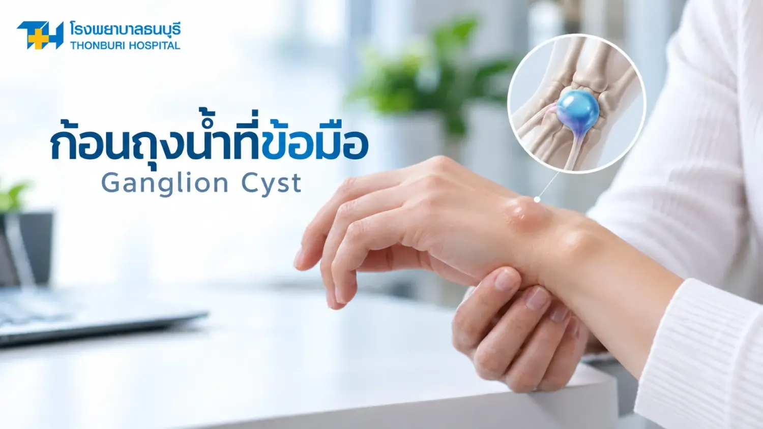 Ganglion Cyst